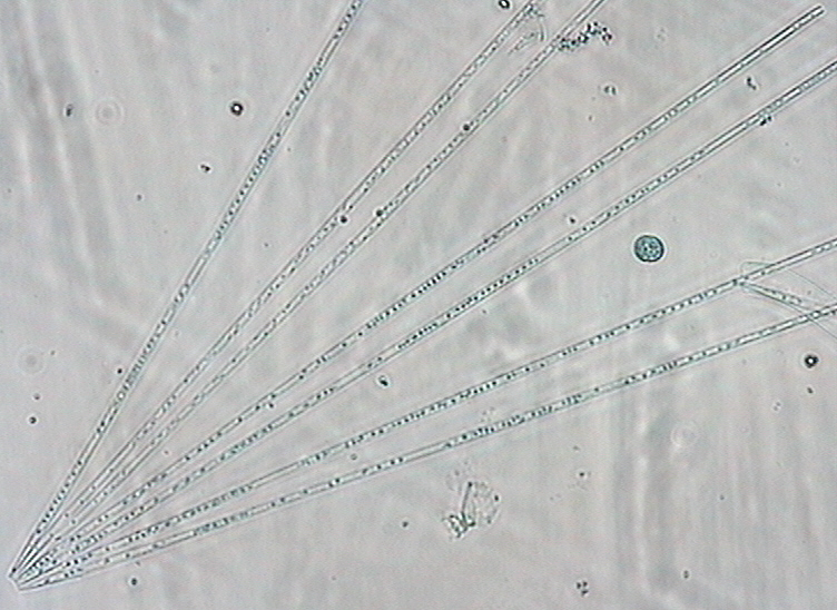 Dictyocha speculum